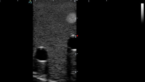 Gphantom Anestesia - Treinamento Guiado Por Ultrassom