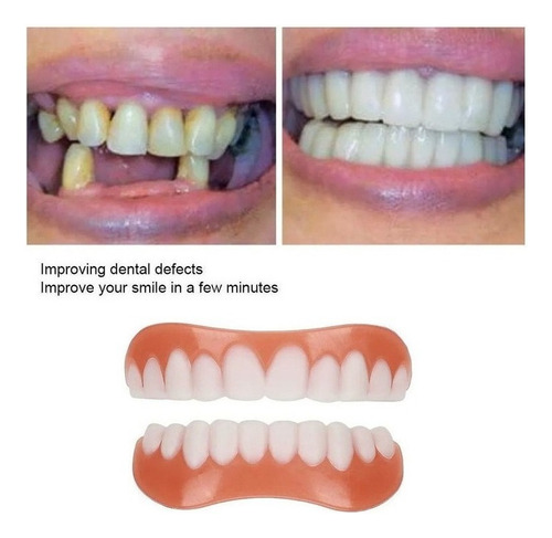 Sonrisa Carillas Cosmética Instantánea Reparación Dientes