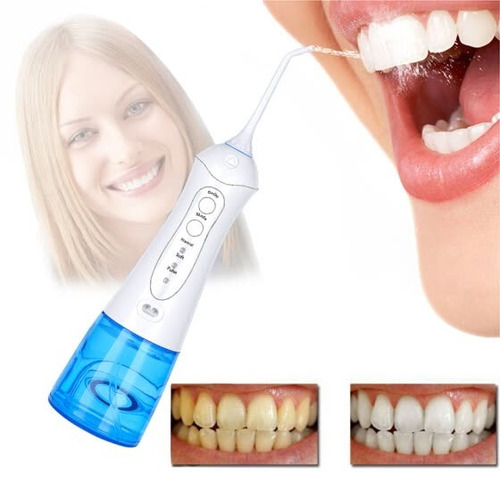 Irrigador Dental Bucal Portable Nicefeel 110psi 300ml