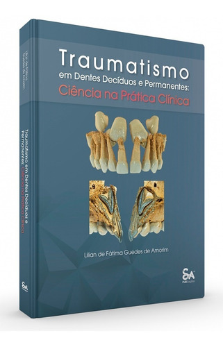 Livro Traumatismo Em Dentes Decíduos E Permanentes, 1ª Ed