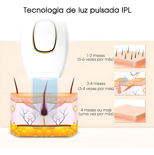 Depilador A Laser Ipl Sistema De Luz Intensa Pulsada 900.000 12v Cor Preto