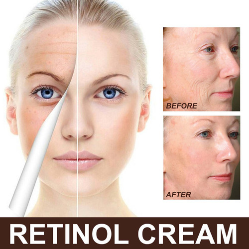 - La Crema Revitalizante Reafirmante U Retrasa El