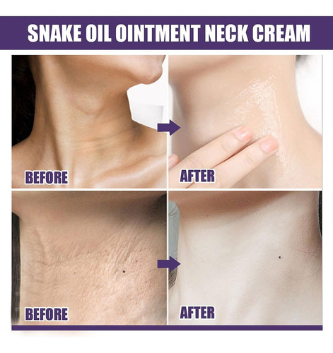Ee Crema Reafirmante Antiaging Aceite De Vibora Para Cuello