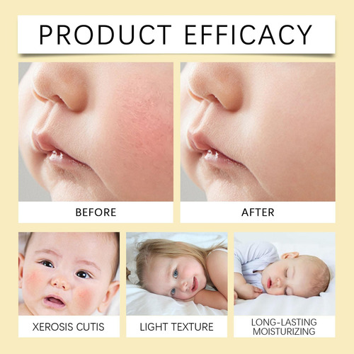 R Crema Hidratante Para Niños Hidratante Hidratante 4012