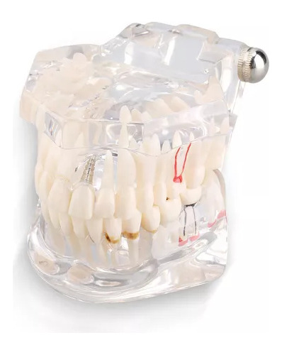 Dentista Dental De Boca Completa Modelo.