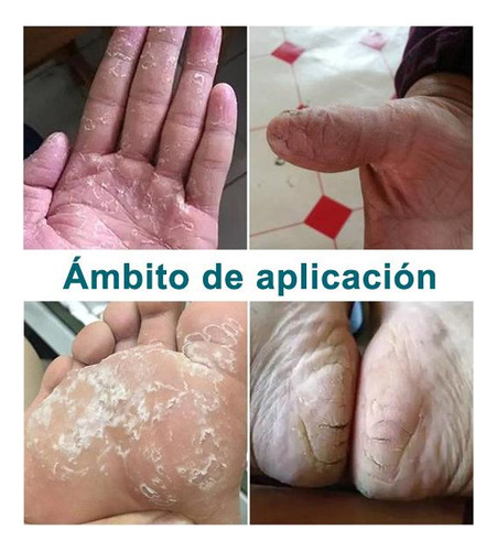 // Artken Reparación Para Pies Agrietados Y Resecos - Crema