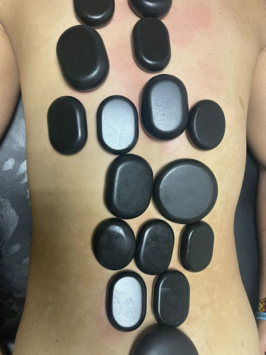 Imagen 5 de 5 de Masajes Relajantes Con Piedras Calientes