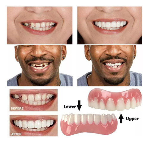 Carillas De Silicona Superiores E Inferiores Para Dientes De