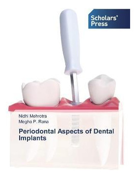 Libro Periodontal Aspects Of Dental Implants - Nidhi Mehr...