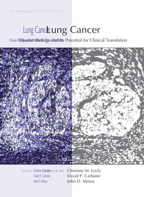 Libro Lung Cancer : Disease Biology And Its Potential For...