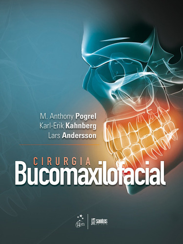 Cirurgia Bucomaxilofacial, de Andersson, M. Anthony. Editora Guanabara Koogan Ltda., capa mole em português, 2016