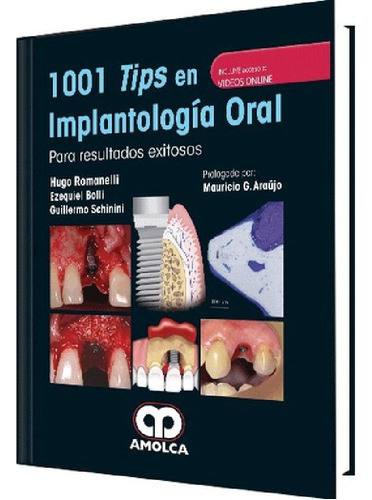 Libro - 1001 Tips En Implantologia Oral Romanelli