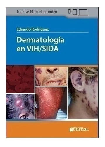 Dermatología En Vih/sida - Rodriguez Nuevo!
