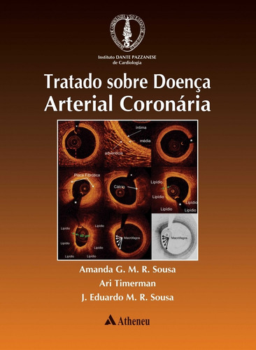 Tratado sobre doença arterial coronária, de Sousa, Amanda G. M. R.. Editora Atheneu Ltda, capa dura em português, 2017