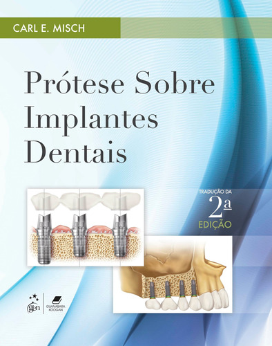 Prótese sobre Implantes Dentais, de Carl E. Misch. Editora Gen – Grupo Editorial Nacional Part S/A, capa mole em português, 2015