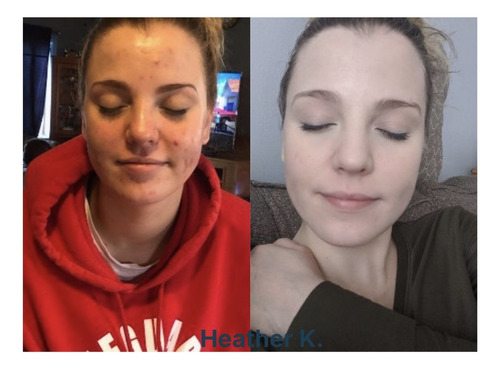 Neora Limpiador Desmaquillante De Rostro Botanico Vegano