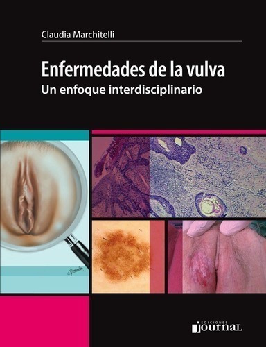 Libro - Enfermedades De La Vulva