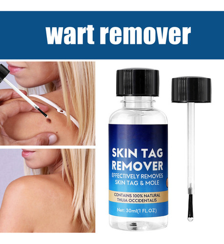 ~ Nitrógeno Líquido Antiwart, Eliminador De Moho