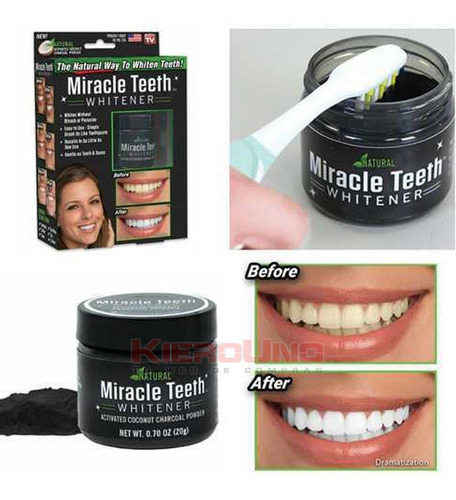 Pasta Blanqueadora Dientes Coco Carbon Blanqueamiento Dental