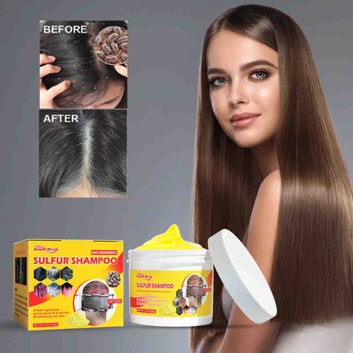 ChampĂș Q Con Azufre Para Eliminar Los Piojos Y Aliviar La Pi