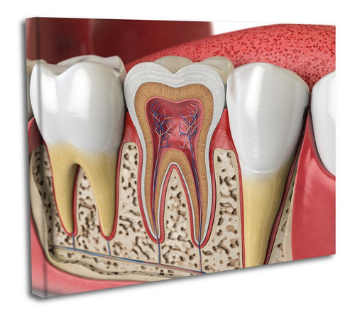 Cuadro Lienzo Canvas 45x60cm Partes Dientes Odontologia