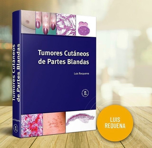 Tumores Cutáneos De Partes Blandas