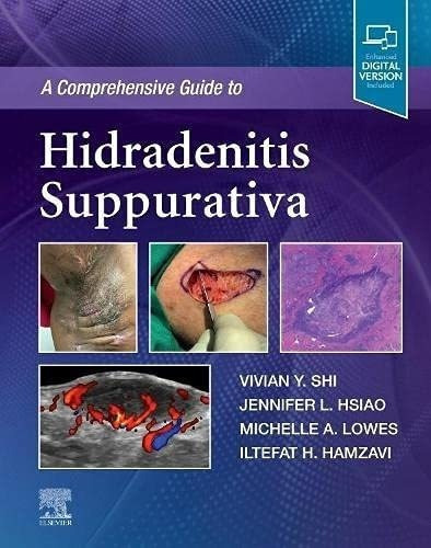 Libro:  A Comprehensive Guide To Hidradenitis Suppurativa