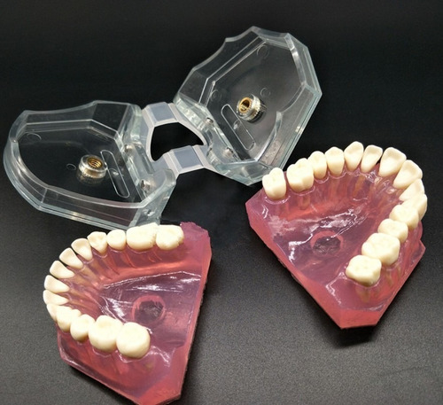 Imagen 10 de 10 de Modelo Acrílico Único Dientes Desmontables Encía Enseñanza