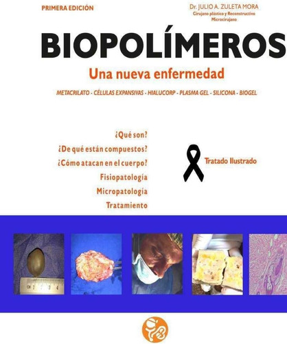 Libro: Biopolimeros: Una Nueva Enfermedad (spanish Edition)