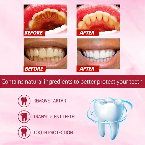 Pasta Dental Probiótica Fj Sp-8 Para El Mal Aliento, 1 Unida