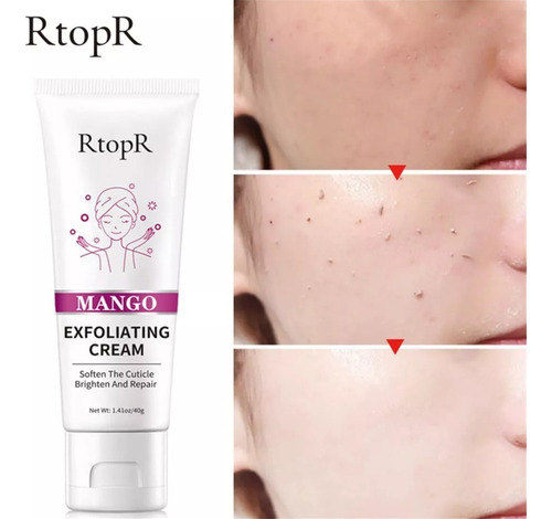 Crema Exfoliante De Mango Rtopr,gel For Limpieza