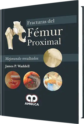 Fracturas Del Fémur Proximal