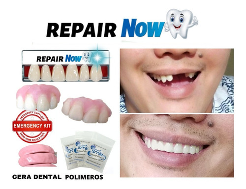 Imagen 2 de 8 de Kit Protesis Dental Diente Provisorio Agnovedades