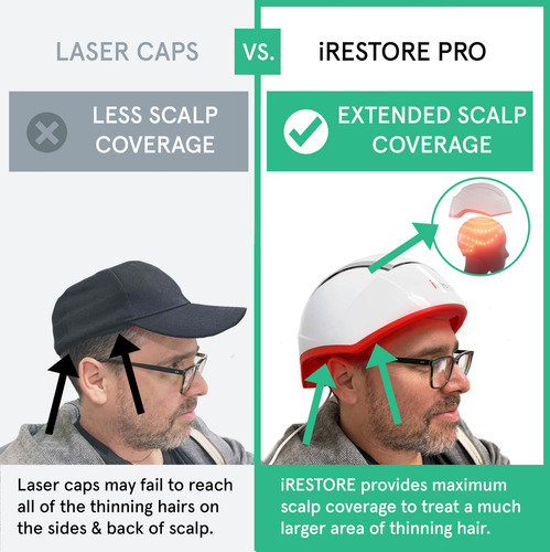 Sistema De Crescimento Capilar A Laser Irestore Professional