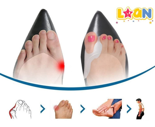 Imagen 6 de 10 de Correctores De Juanetes Con Protector Gel X2 T/valgomed