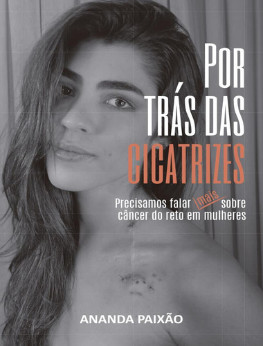 Por Tras Das Cicatrizes - Precisamos Falar Sobre O Cancer De Reto Em Mulheres, De Paixao, Ananda. Editora Método, Capa Mole, Edição 1 Em Português, 2023