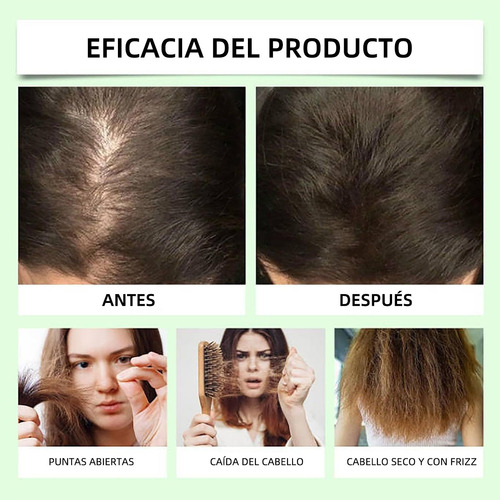 Ae Champú Anticaída Del Cabello Remimpi 2pcs