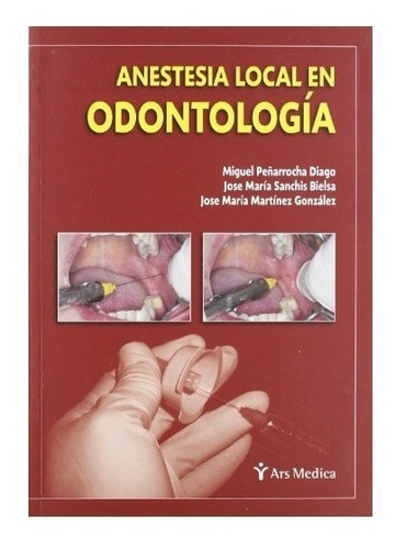Anestesia Local En Odontología Peñarrocha Ars Medica
