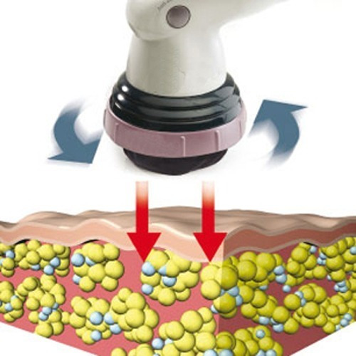 Imagen 7 de 10 de Masajeador Profesional Celulitis Calor Infrarrojo Linfático