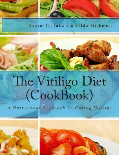 The Vitiligo Diet (cookbook), De Suneel Chilukuri. Editorial Createspace Independent Publishing Platform, Tapa Blanda En Inglés
