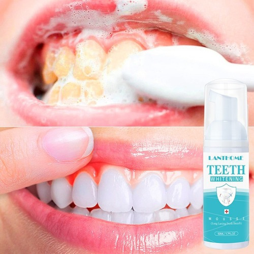 2 Unidades De Pasta De Dientes Blanqueadora En Espuma Blanqu