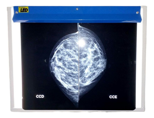 Negatoscopio Led Para Mamografia Digital , Rx E Odonto.