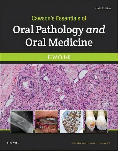 Cawson's Essentials Of Oral Pathology And Oral Medicine, De Edward W Odell. Editorial Elsevier Health Sciences En Inglés