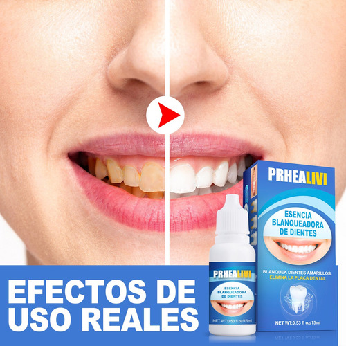 Esecia Blanqueadora De Dientes Para Higiene Y Limpieza Oral