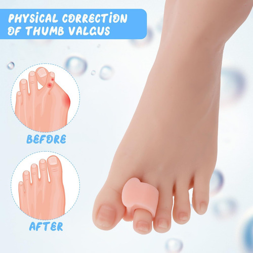 12 Piezas De 2 Tamaños Para Enderezar Los Dedos De Los Pies