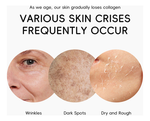 Mascarilla Hidratante Para La Piel Facial Y Reductora De Arr