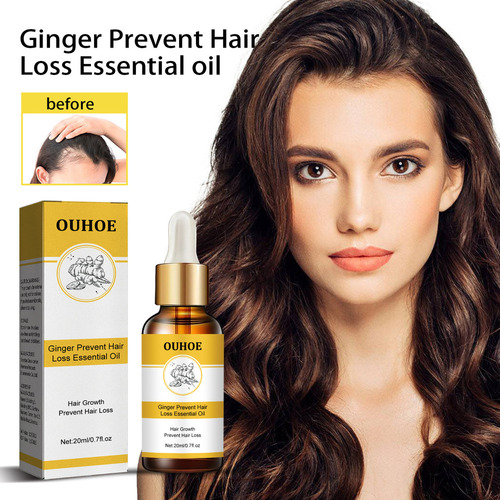 Óleo De Gengibre Para Perda De Cabelo, 20 Ml