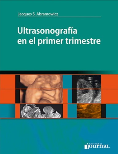 Ultrasonografía En El Primer Trimestre