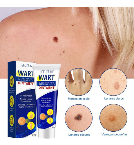 3pcs Crema Eliminadora Verrugas Sefudun Crema Eliminadora