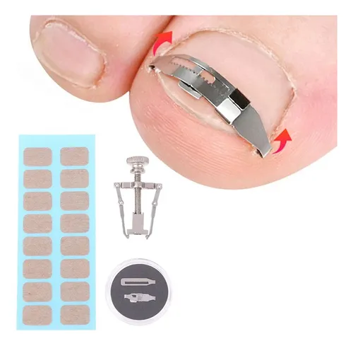comprar Kit Adesivos 2 Ferramentas Órtose Correção Unhas Encravadas